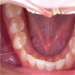 Diagnostika ortodontických anomálií na fotografiích chrupu, 1. díl