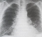 Interní propedeutika – vyšetření dýchacího ústrojí