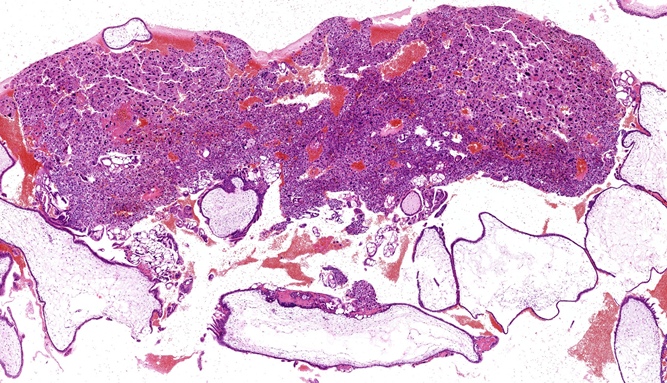 Educational Portal: Hypertext atlas of Fetal Pathology