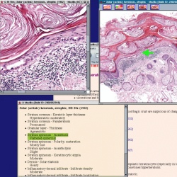 Sample of Hypertext Atlas