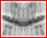 Multimediální atlas pro výuku stomatologické chirurgie - retence zubů a vývojové odontogenní cysty