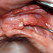 Onemocnění sliznice ústní dutiny – repetitorium a atlas