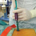 Odběr a zpracování kostní dřeně pro transplantaci krvetvorby